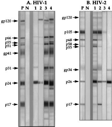 hiv western blot positive